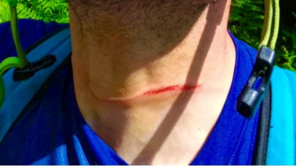 neckguard collare di protezione per il collo