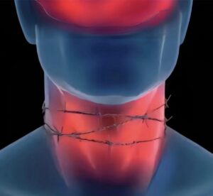 NECKGUARD FORKSAVER COLLARE DI PROTEZIONE COLLO