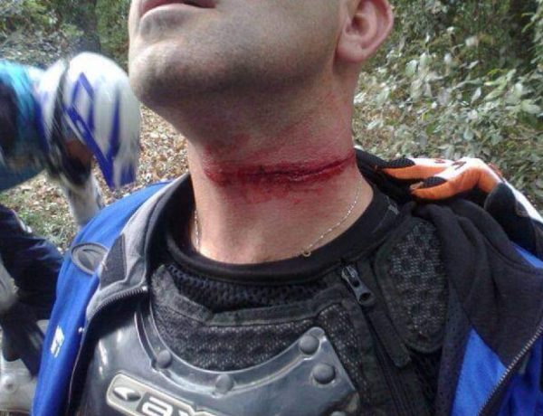 Collare di protezione Enduro Bike MTB